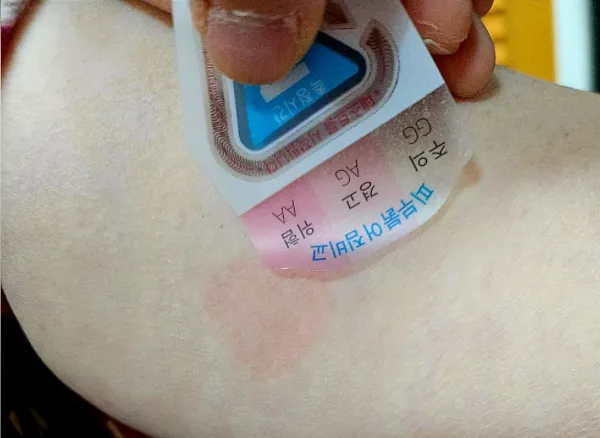 알쓰패치 실사용 후기 — 재밌게 해본 알쓰패치 체험