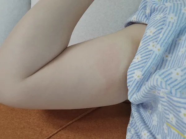 알쓰패치 실사용 후기 — 간단히 테스트할 수 있어 좋았어요